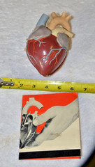 1960’s Merck Sharp Dohme Aldomet Heart Model Pharmaceutical Ad Methyldopa MSD