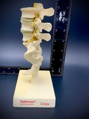 Rare Geigy Voltaren Medical Advertising Spine Model – Anatomical Lumbar/Sacrum