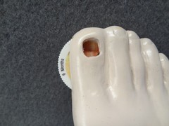 Janssen Sporanox Capsule Foot Display Model Prop Doctor Office Advertisement EUC