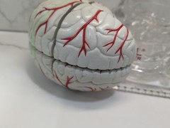 Gliadel Human Brain Anatomy Model w/ Clear Skull PharmaDesign Medical Display