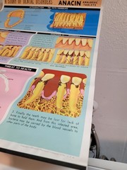 Vintage ANACIN Tablets WHITEHALL Laboratories ADVERTISING Dentist DENTAL POSTER