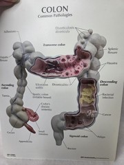 Colon Display GPI Anatomicals 2001