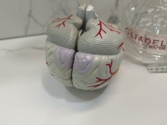 Gliadel Human Brain Anatomy Model w/ Clear Skull PharmaDesign Medical Display