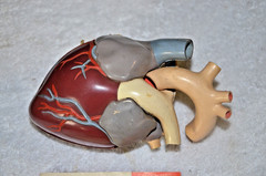 1960’s Merck Sharp Dohme Aldomet Heart Model Pharmaceutical Ad Methyldopa MSD