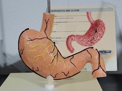 Vtg Prevacid & Zelnorm Doctor Pharmaceutical Display Esophagitis & Ulcers