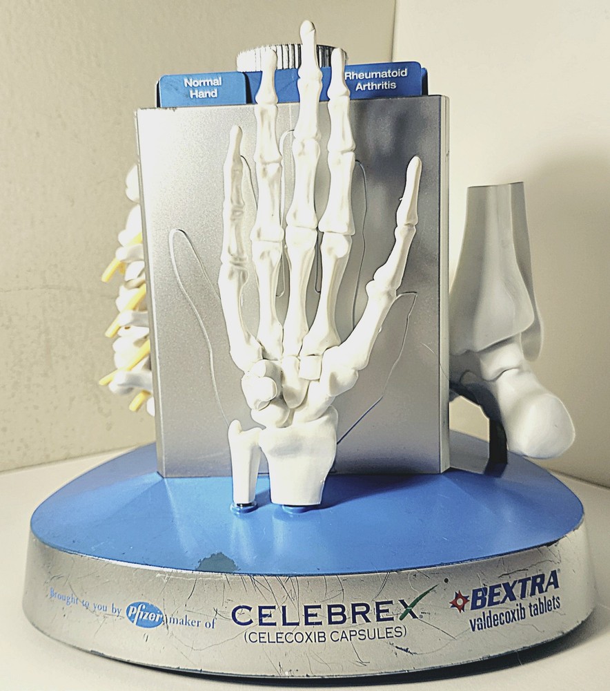 „Anatomical Arthritis Model“ Of a Hand, Foot, & Spine ~Pfizer~ Celebrex/Bextra