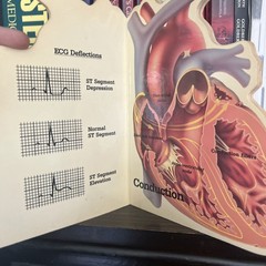 Heart Book Patient Guide to the Human Heart Transderm Nitro Advertising Medical