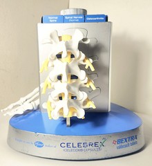 „Anatomical Arthritis Model“ Of a Hand, Foot, & Spine ~Pfizer~ Celebrex/Bextra