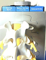 „Anatomical Arthritis Model“ Of a Hand, Foot, & Spine ~Pfizer~ Celebrex/Bextra
