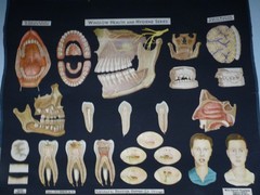 „DENTAL HYGIENE“ 1930S PULL DOWN MEDICAL CHART , DENOYER GEPPERT 44X36