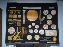 „GERMS & GERM DISEASES“ 1930S PULL DOWN MEDICAL CHART , DENOYER GEPPERT 44X36