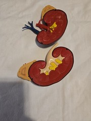 Vintage 1961 Merck & Co Pharmaceuticals Plastic Model Human Kidney Organ 5″