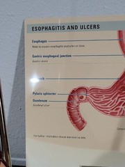 Vtg Prevacid & Zelnorm Doctor Pharmaceutical Display Esophagitis & Ulcers