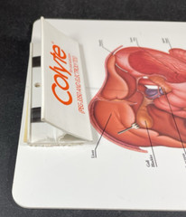 Medical Clipboard w/Calculator COLYTE Pharmaceutical Drug Rep Promo 14″x9″