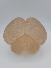 Vintage Lucite Acrylic Brain Cerebellum Model Medical Pharmaceutical Science