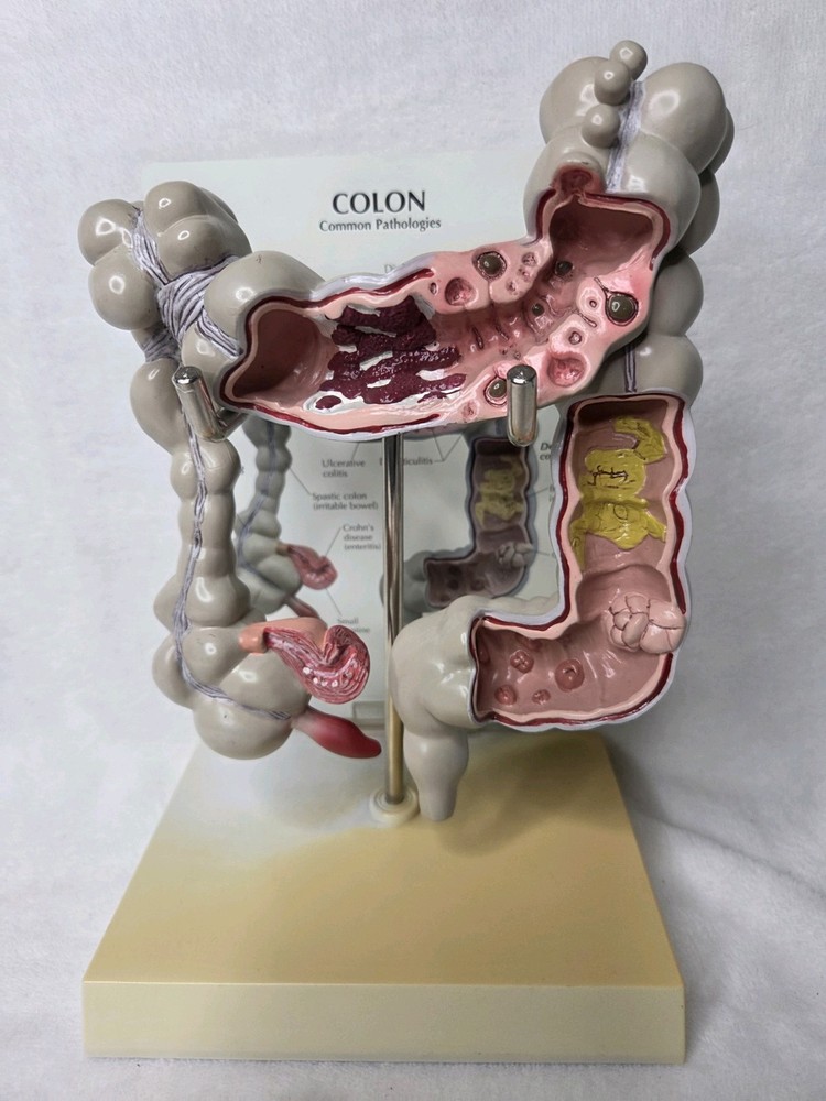 Colon Display GPI Anatomicals 2001