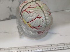 Gliadel Human Brain Anatomy Model w/ Clear Skull PharmaDesign Medical Display