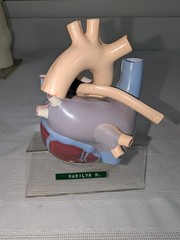 1960s Merck Pharmaceutical Advertising Model „Hydrodiuril Hydropres“ Model