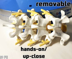 „Anatomical Arthritis Model“ Of a Hand, Foot, & Spine ~Pfizer~ Celebrex/Bextra