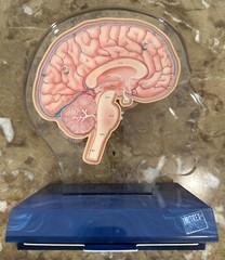 Imitrex (Sumatriptan) 3D 9″ Neuroanatomy Model with Legend – Brain Anatomy