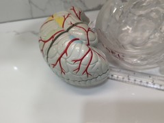 Gliadel Human Brain Anatomy Model w/ Clear Skull PharmaDesign Medical Display