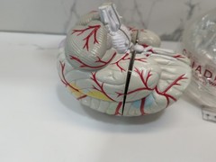 Gliadel Human Brain Anatomy Model w/ Clear Skull PharmaDesign Medical Display