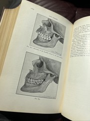 RARE Oral Surgery 1915 Illustrated Medical Dentistry Disease Truman W Brophy