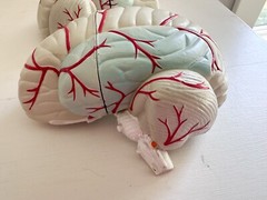 UCB Pharma Lucite Head Skull Brain Model Medical Pharmaceutical Science Display