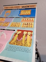 Vintage ANACIN Tablets WHITEHALL Laboratories ADVERTISING Dentist DENTAL POSTER