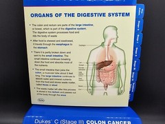 NIB Roche Pharmaceutical Xeloda Colon Cancer Anatomical Model & Chart Display