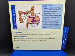 NIB Roche Pharmaceutical Xeloda Colon Cancer Anatomical Model & Chart Display