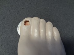 Janssen Sporanox Capsule Foot Display Model Prop Doctor Office Advertisement EUC