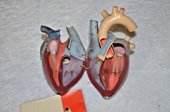 1960’s Merck Sharp Dohme Aldomet Heart Model Pharmaceutical Ad Methyldopa MSD