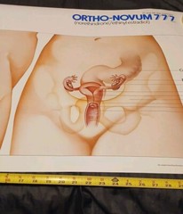 Vinatge 1986 Female Reproductive System ORTHO-NOVUM 777 20×34 Poster ORTHO…