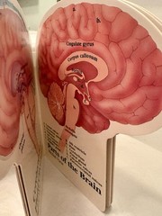 VTG 1990 TEGRETOL „PATIENT GUIDE TO THE HUMAN BRAIN“ PHARMA LOGO ADVERTISING