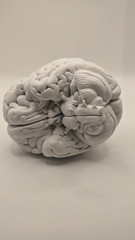 Alkermes Anatomical Brain Model Pharmaceutical Promo Desk Display