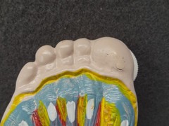 Janssen Sporanox Capsule Foot Display Model Prop Doctor Office Advertisement EUC