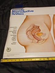 Vinatge 1986 Female Reproductive System ORTHO-NOVUM 777 20×34 Poster ORTHO…