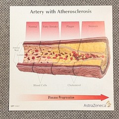 Drug Rep Promo AstraZeneca Cholesterol Artery Display Model w Educ. Flyers 2007