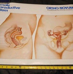 Vinatge 1986 Female Reproductive System ORTHO-NOVUM 777 20×34 Poster ORTHO…