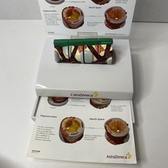 AstraZeneca Bronchus Airway Medical Anatomical Model Doctor Office Display