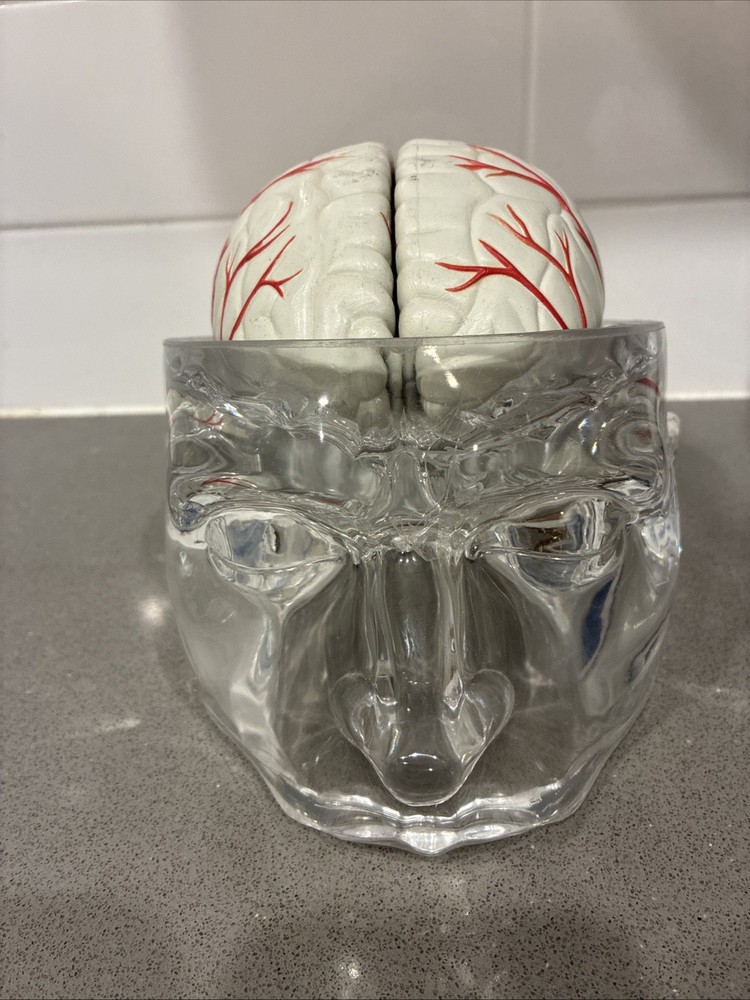 Seroquel Human Brain Anatomy Model w/ Clear Skull PharmaDesign Medical Display