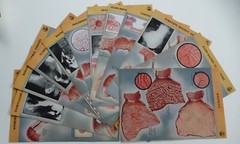 18 Ciba Pharmaceutical Folders w/ Color Plates – Pathology Anatomy War Injuries
