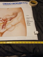 Vinatge 1986 Female Reproductive System ORTHO-NOVUM 777 20×34 Poster ORTHO…