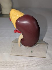 1960s Merck Pharmaceutical Advertising Model „Hydrodiuril Hydropres“ Model