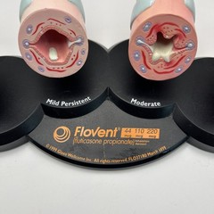 Flovent Asthma Trachea Bronchus Anatomical Pathology Model Pharmadesign 1999