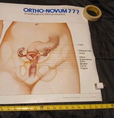 Vinatge 1986 Female Reproductive System ORTHO-NOVUM 777 20×34 Poster ORTHO…