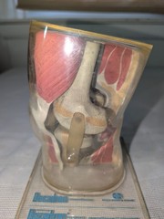 1960s Merck Pharmaceutical Advertising Model „Decadron“ Knee Model