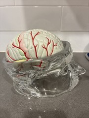 Seroquel Human Brain Anatomy Model w/ Clear Skull PharmaDesign Medical Display