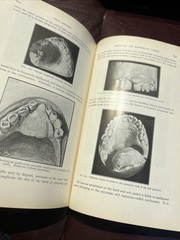 RARE Oral Surgery 1915 Illustrated Medical Dentistry Disease Truman W Brophy